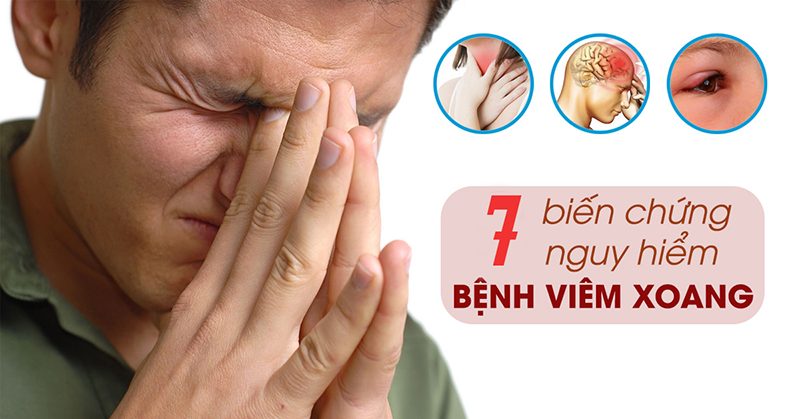7 Bien Chung Cua Viem Xoang