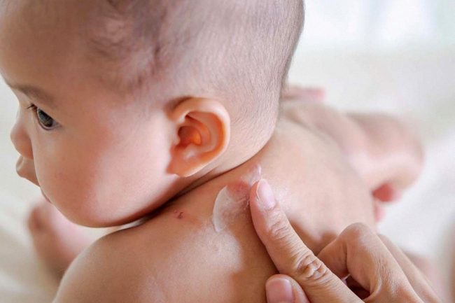 Thuoc Boi Viem Da O Tre So Sinh