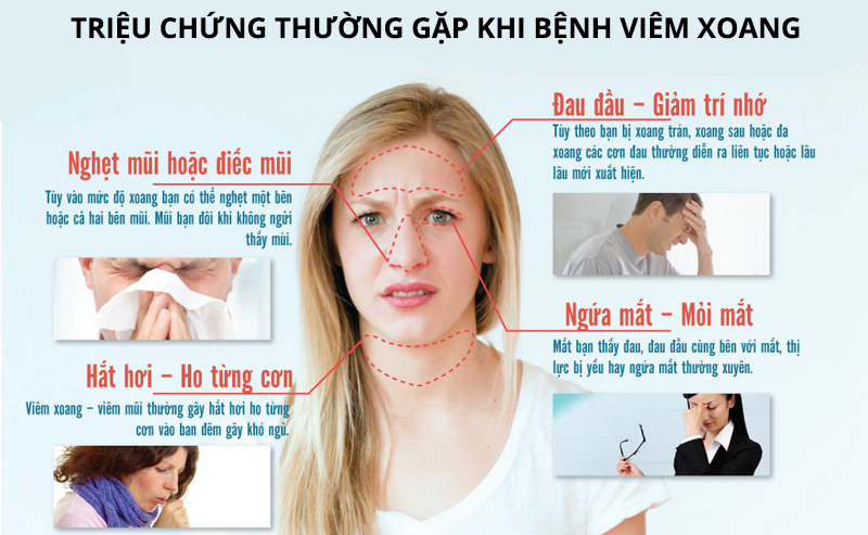 Trieu Chung Cua Viem Xoang Mui