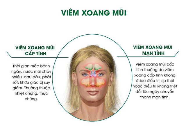 Viem Xoang Mui