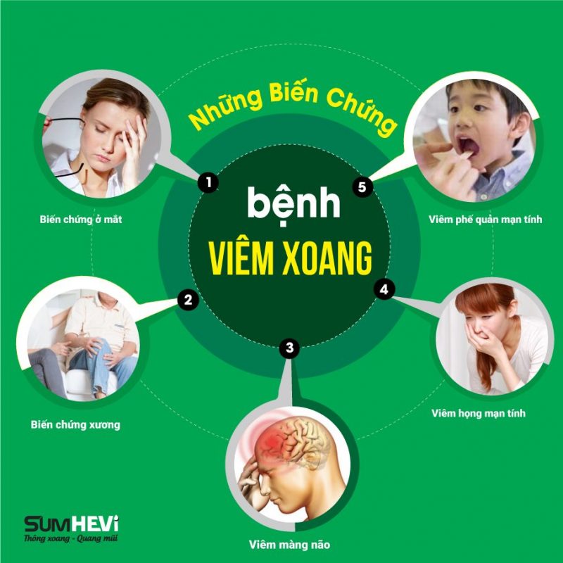 Bien Chung Cua Viem Xoang