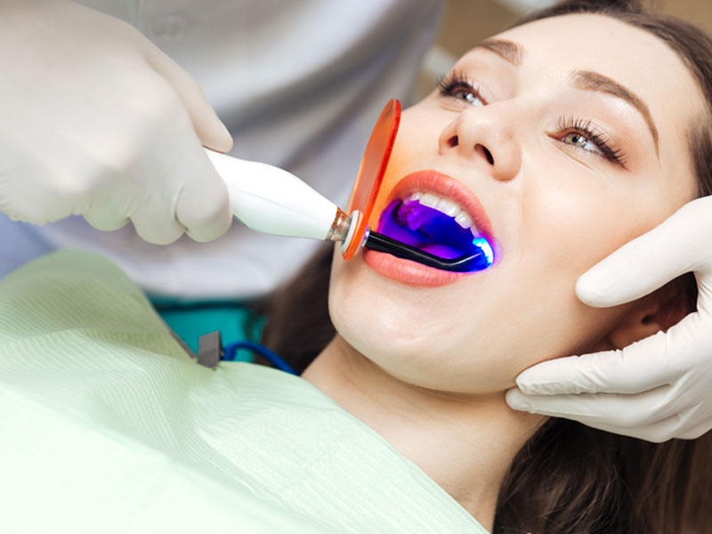 Tẩy trắng răng công nghệ Plasma