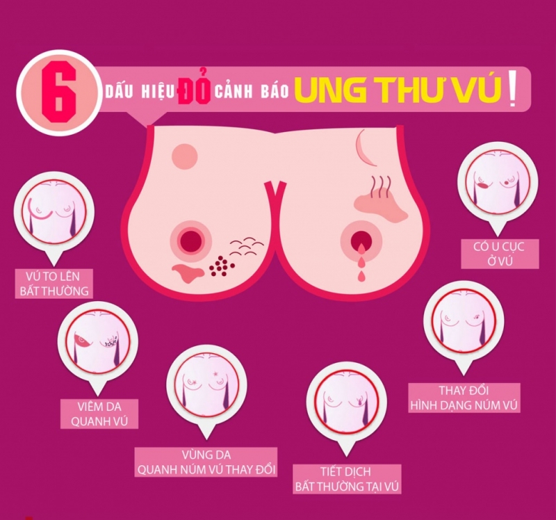Ung thư vú có khả năng di truyền