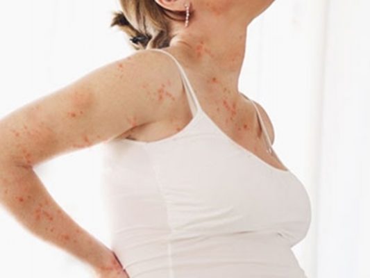 1564367779684 2593625 1 1