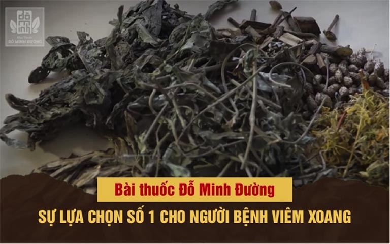 Bài thuốc viêm xoang của Đỗ minh đường 