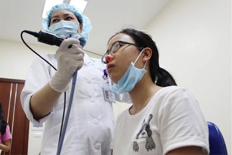 Chẩn đoán viêm xoang 