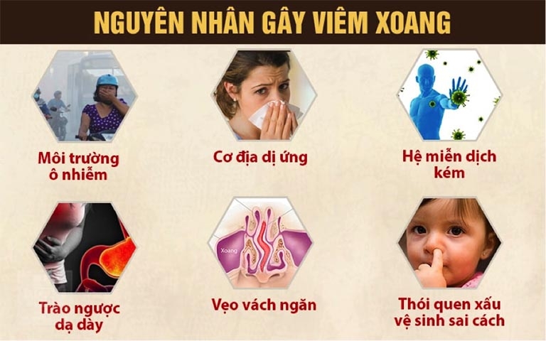 Nguyên nhân gây bệnh viêm xoang 