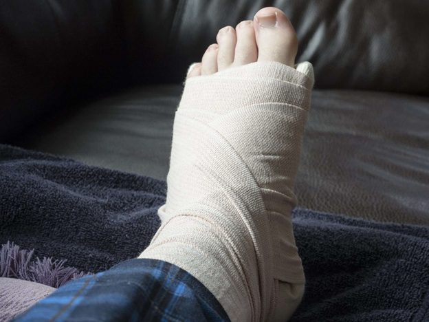 Sưng chân là dấu hiệu của tim bị phù nề