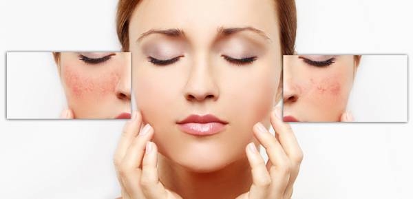 5 sản phẩm kem chống nắng được chị em săn đón 5 sản phẩm kem chống nắng được chị em săn đón