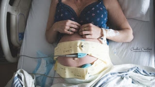 Người mắc bại não có nên sinh con?