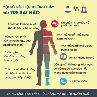 60.000 Trẻ em VN mắc chứng bại não bẩm sinh - Cách phòng tránh bại não