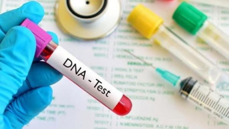 Tìm hiểu về xét nghiệm ADN