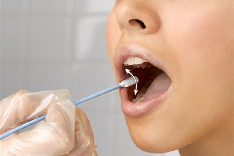 Tế bào niêm mạc miệng