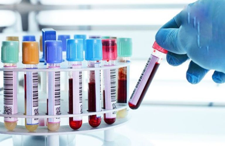 Xét nghiệm ADN cần những giấy tờ pháp lý gì?