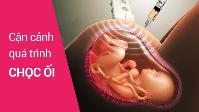 xét nghiệm adn thai nhi