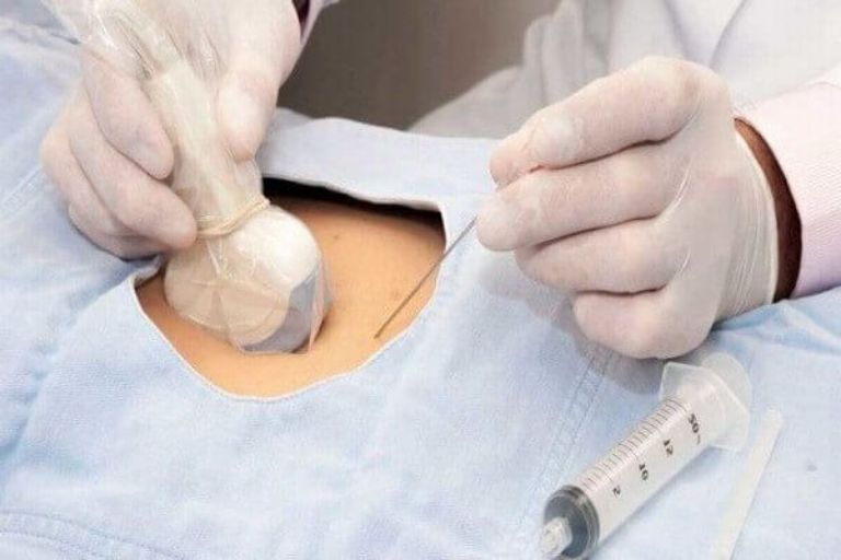 xét nghiệm adn thai nhi