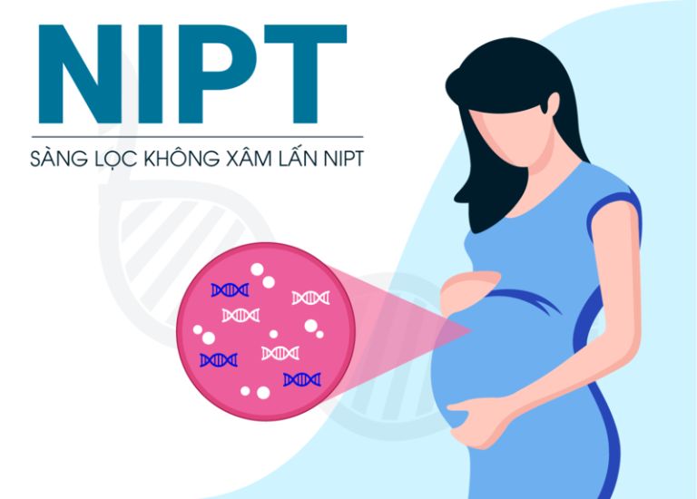 Xét nghiệm nipt