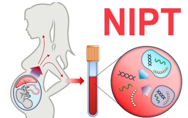 Chi phí xét nghiệm Nipt