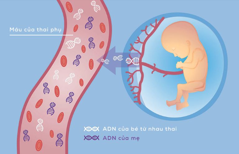 bản chất của xét nghiệm nipt