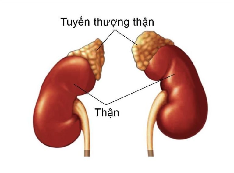Bệnh tăng sản thượng thận bẩm sinh
