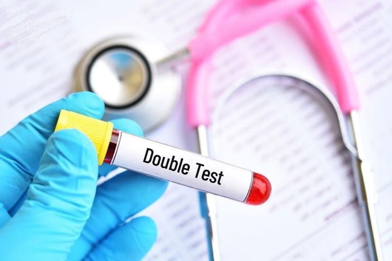 Xét nghiệm Double Test