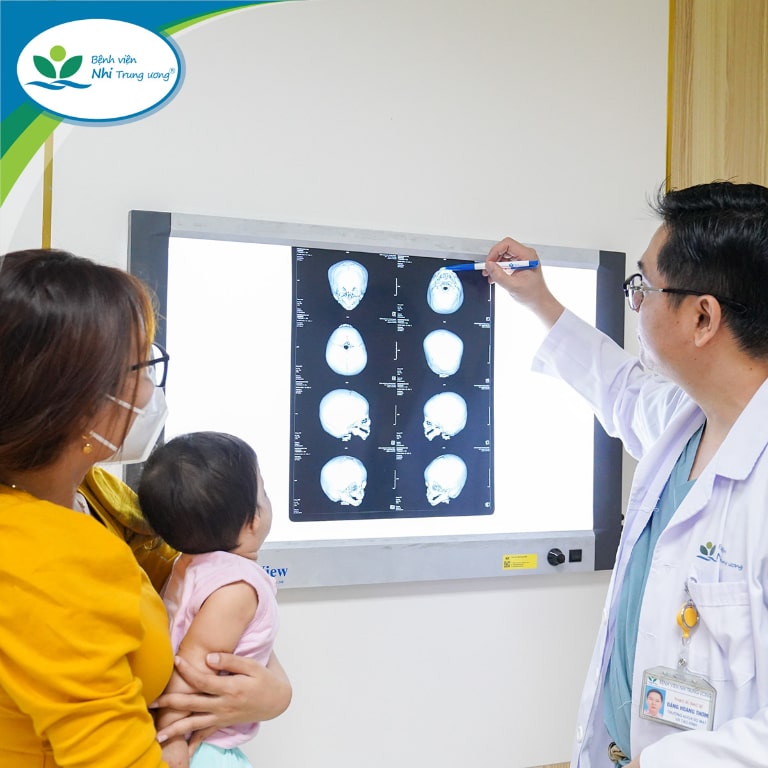 Các địa chỉ khám cho trẻ chậm đi uy tín tại Hà Nội