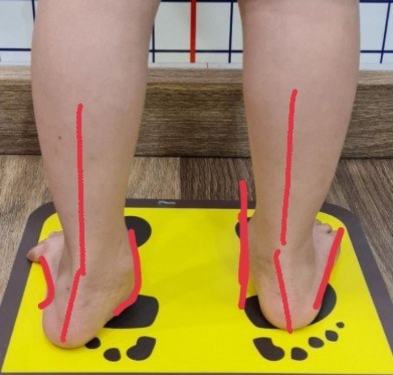 Hệ thống Trung tâm VinaHealth đã thống nhất được một số điều khoản mang lại lợi ích cho các trẻ đặc biệt
